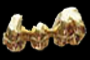 666 Dental Gold